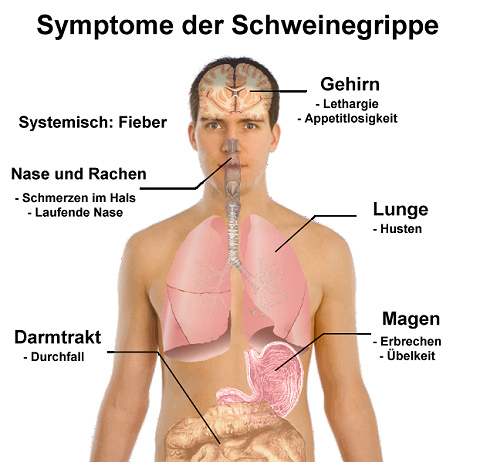 schweinegrippe-bild schweinegrippe-bild