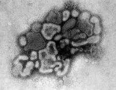 Influenza A/H1N1 Virus