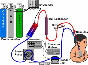 ECMO Gerät