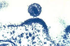 Sich aus einer Immunzelle herauslösendes HI-Virus