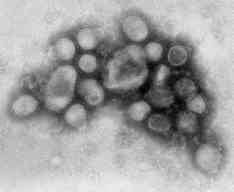 Influenza A/H1N1 Virus