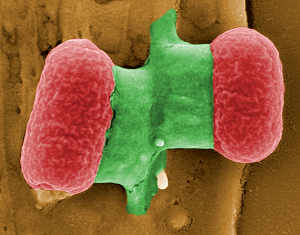 Bild: Manfred Rohde, Helmholtz-Zentrum für Infektionsforschung (HZI)