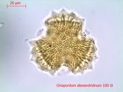 Pollen unter dem Durchlichtmikroskop: Er stammt von Onopordum alexandrinum, einer Distelart aus dem Nahen Osten, die Steppenklima anzeigt. (c) Foto: Arbeitsgruppe Paläobotanik/Uni Bonn