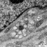 Elektronenmikroskopische Aufnahme einer Coronavirus-infizierten Zelle mit zahlreichen Membranvesikel ... Bild: Volker Thiel, IVI, Universität Bern.