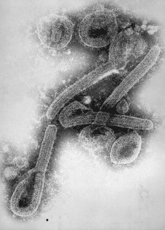 Elektronenmikroskopische Darstellung des Marburg-Virus