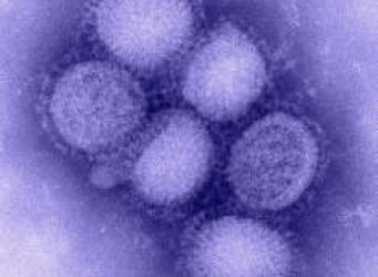 schweinegrippe-virus