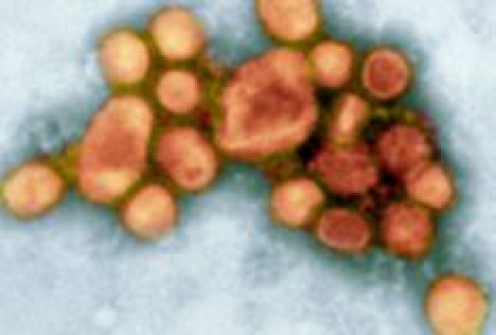 H1N1 Virus