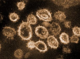 coronavirus2