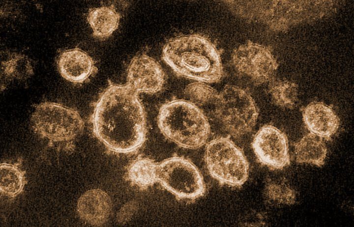 coronavirus2